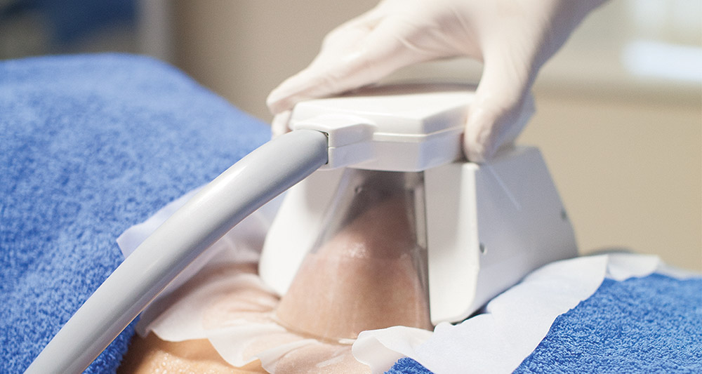 How Fat Freezing and HIFU Work Together? 2 Multiple Areas in One Session HIFU and Fat Freezing Ashtead