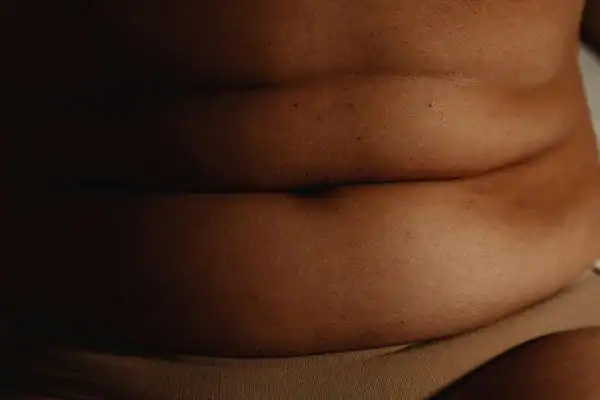 The Hidden Connection: How Stress Shapes Your Fitness and Body Composition 3 image of what stress can do on the stomach area and how Lipo 360 Ashtead can help to change your body shape.