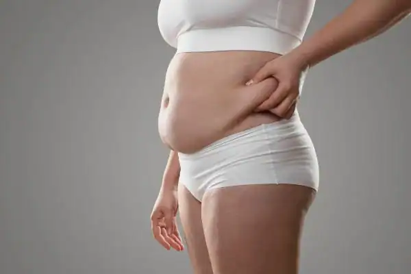 Image of stress belly Ashtead How Lipo 360 can help manage your symptoms