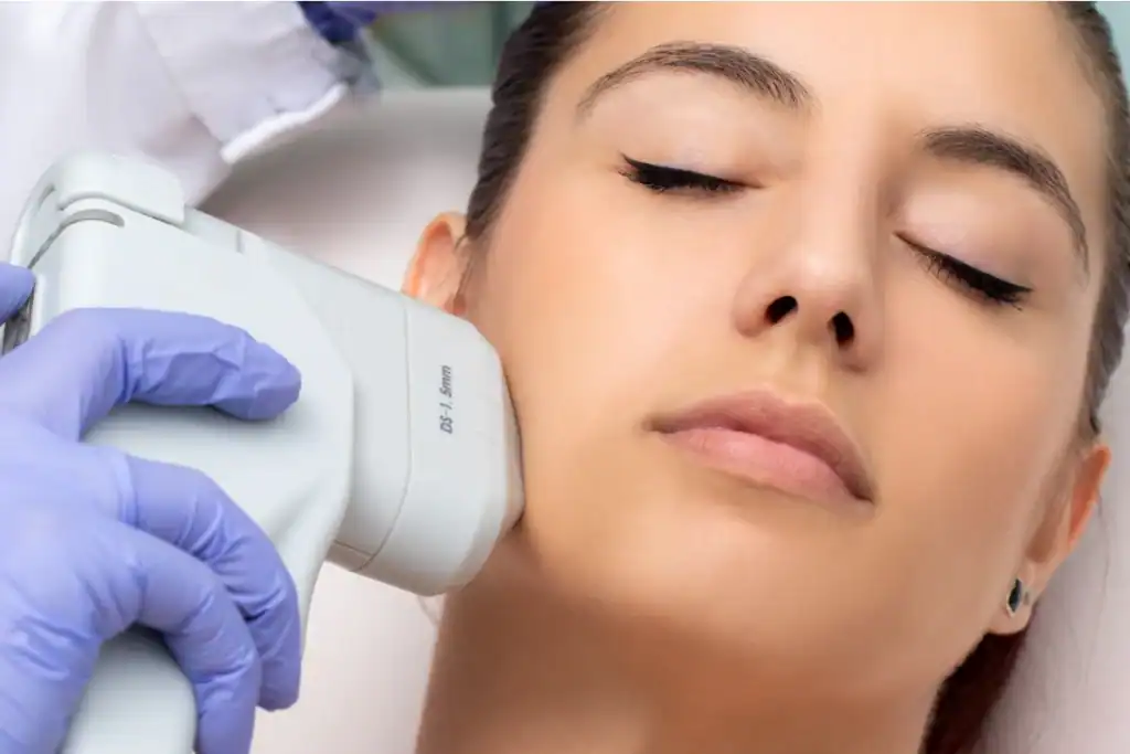 Discover the Perfect Duo: RF Microneedling and HIFU 2 Image of Morpheus8 And HIFU Combined with Lipo 360 Ashtead