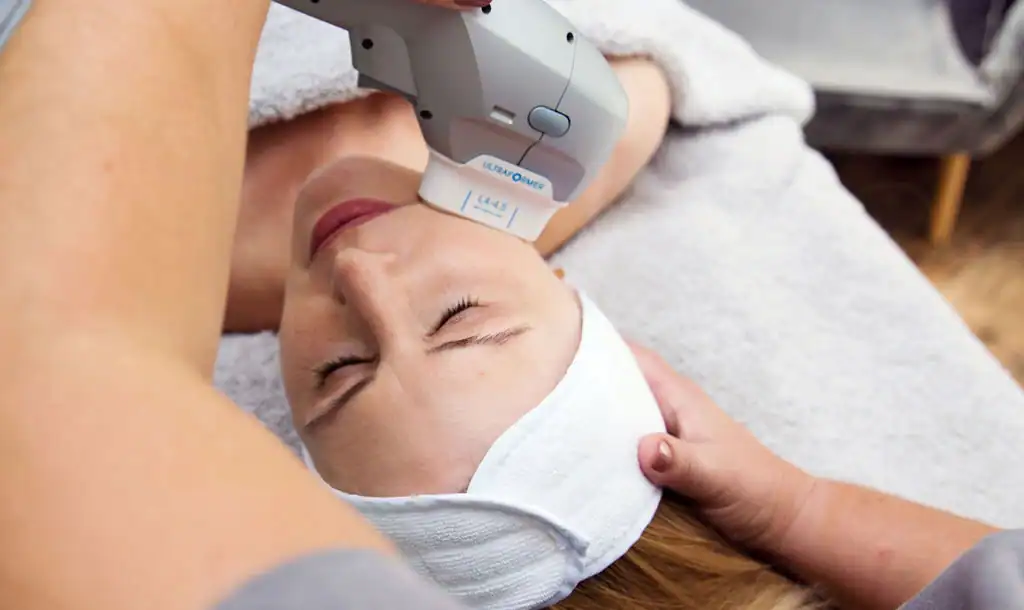 Discover the Perfect Duo: RF Microneedling and HIFU 1 Image of Morpheus8 And HIFU Ashtead combined treatment